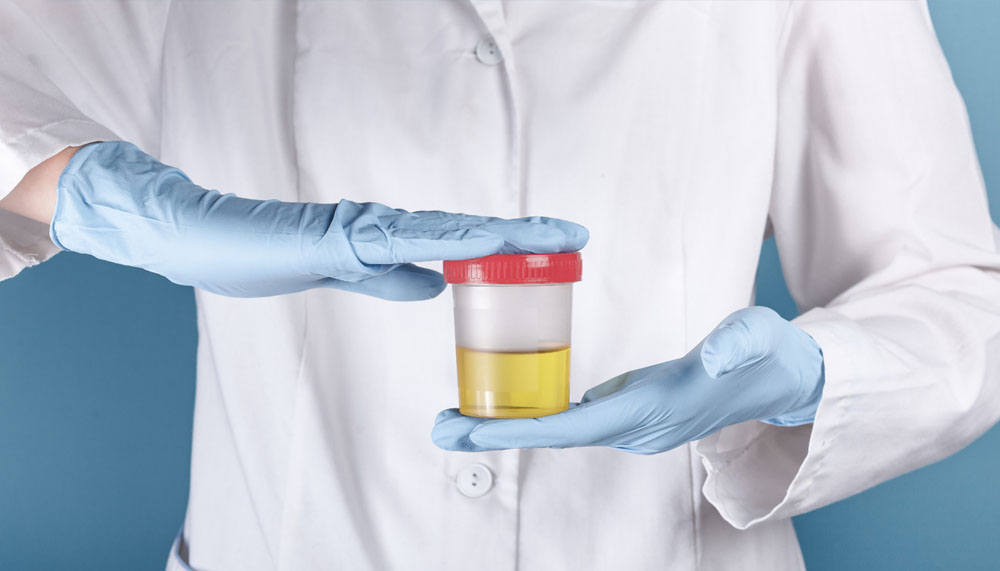 DOT Urine test